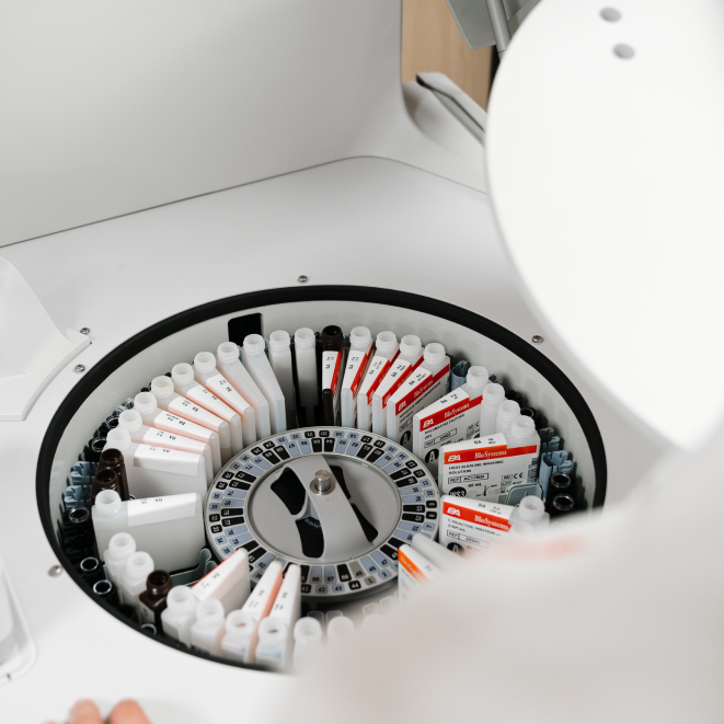 BioSystems BA200 Control Panel and Display Detail